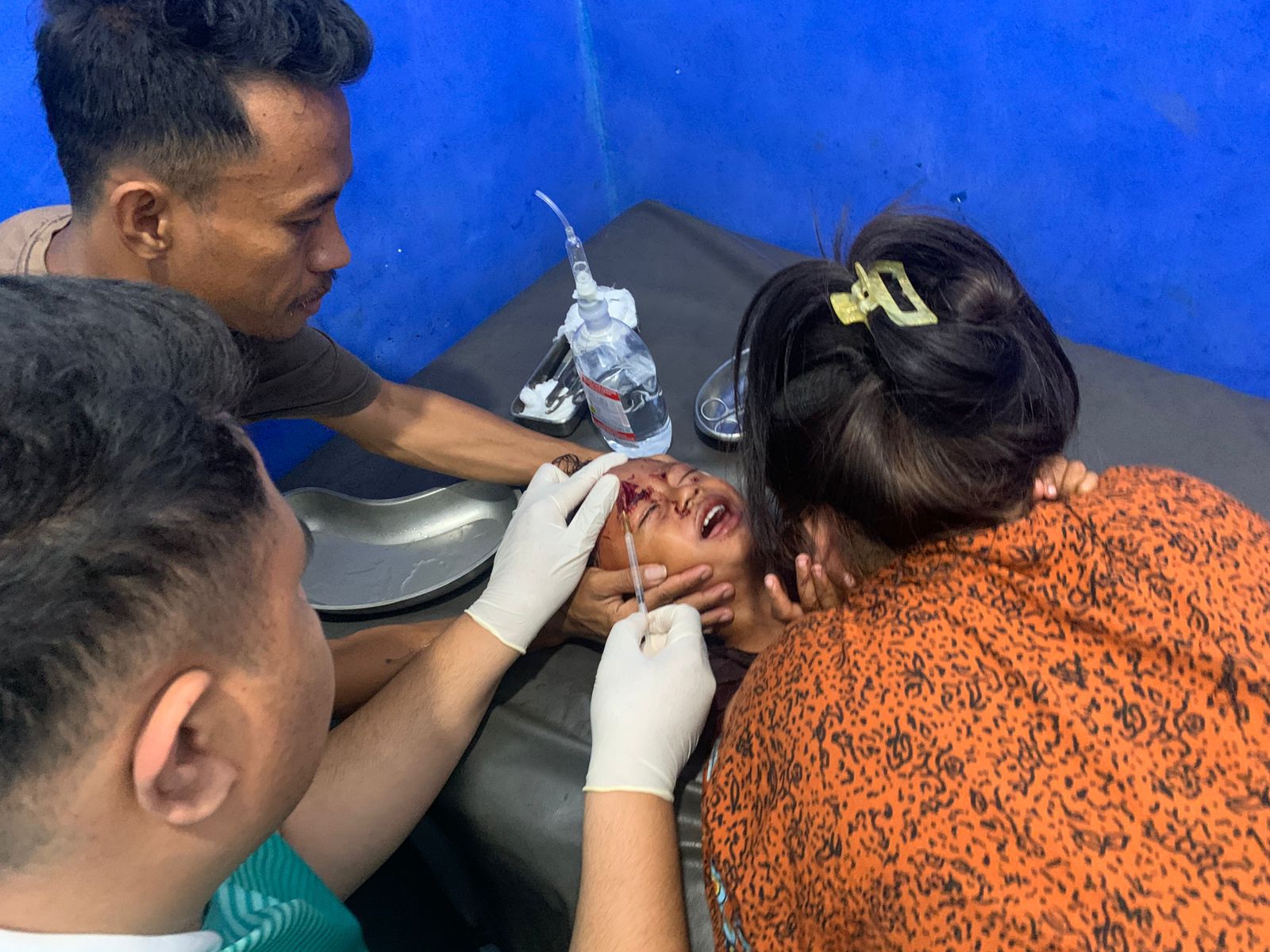 Bocah 3 Tahun Diserang Anjing Diduga Rabies di Dompu, Polisi Imbau Warga Tingkatkan Kewaspadaan